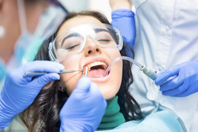 Teeth Scaling Why It’s More Important Than You Think